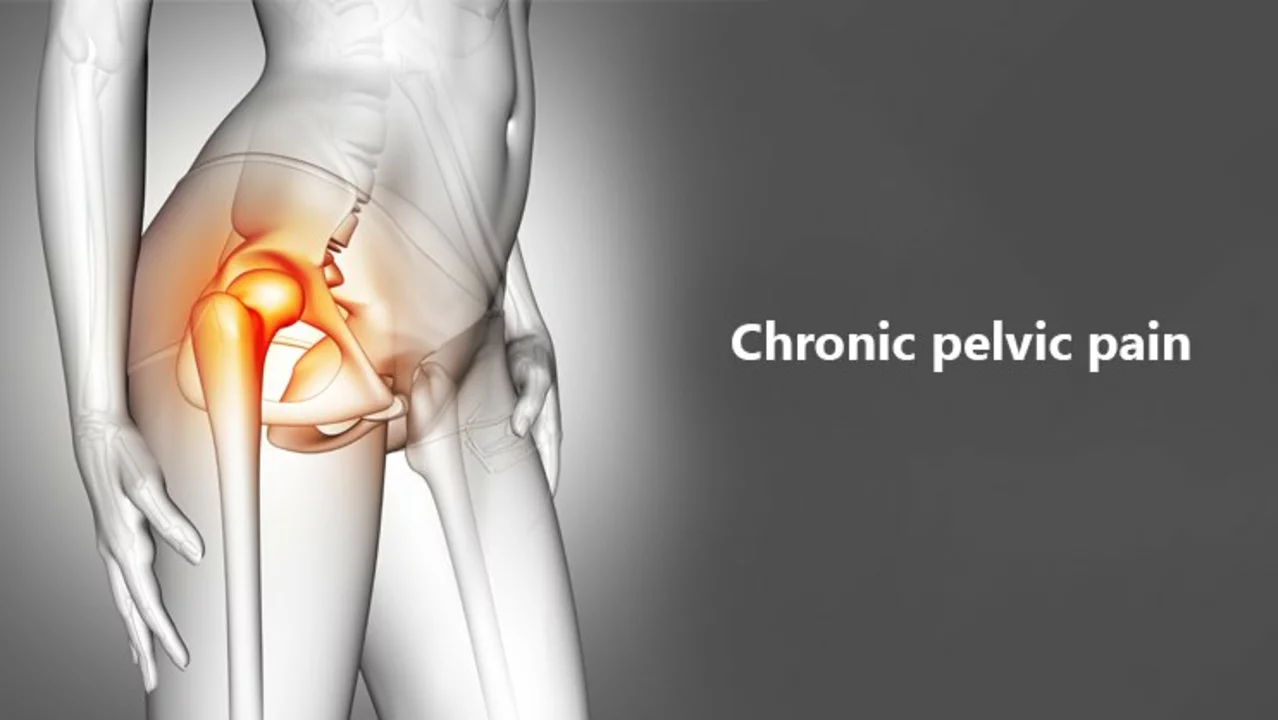 The Role of Amitriptyline in Managing Chronic Pelvic Pain