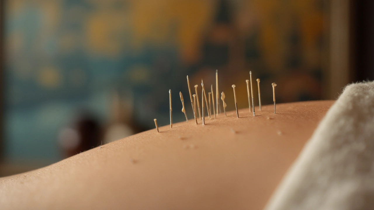 Tips for Trying Acupuncture